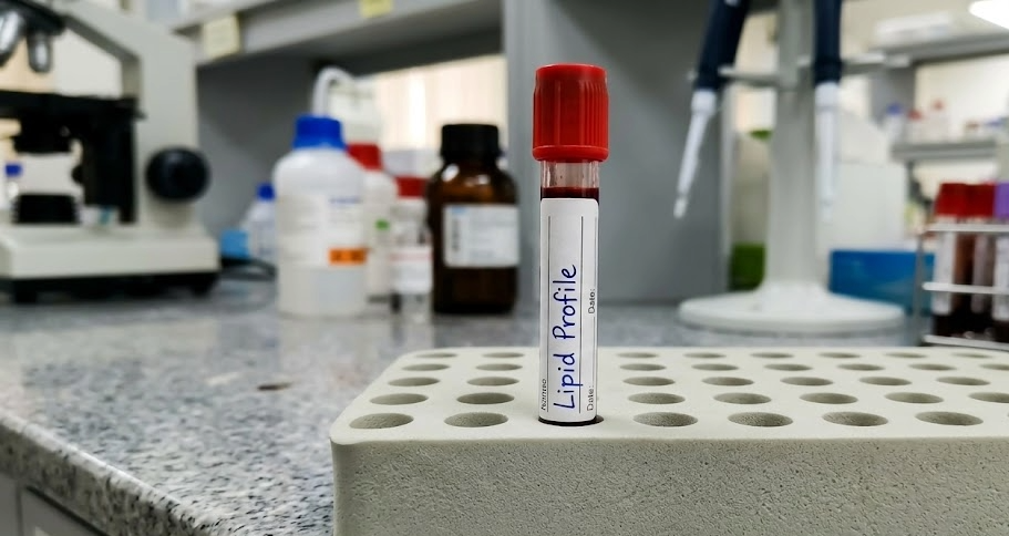 LDL, HDL and triglycerides explained: which cholesterol number matters?