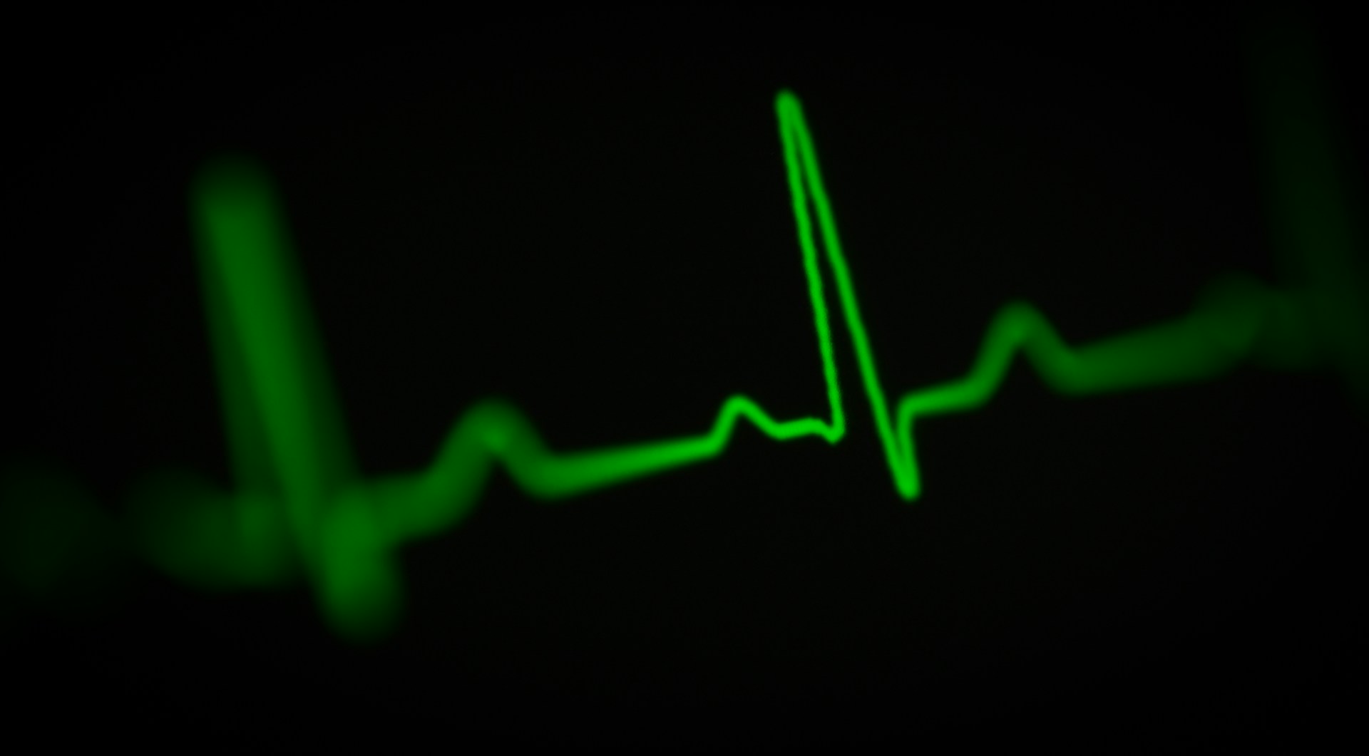 Heart Rate Variability: What Your Wearable Shows and What Your Health Report Explains